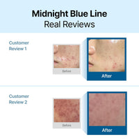 dear, klairs Midnight Blue Calming Cream | 60ml