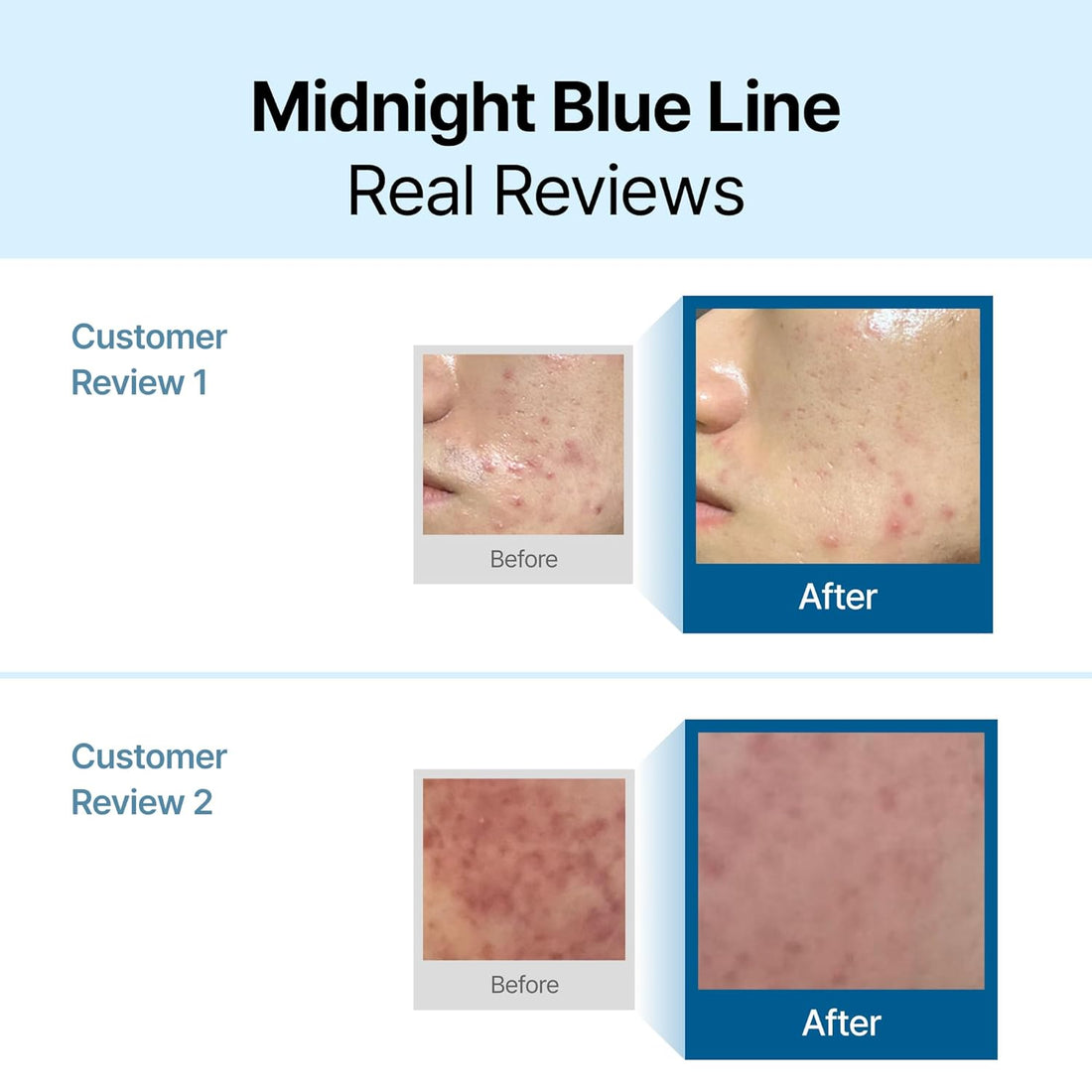 dear, klairs Midnight Blue Calming Cream | 60ml