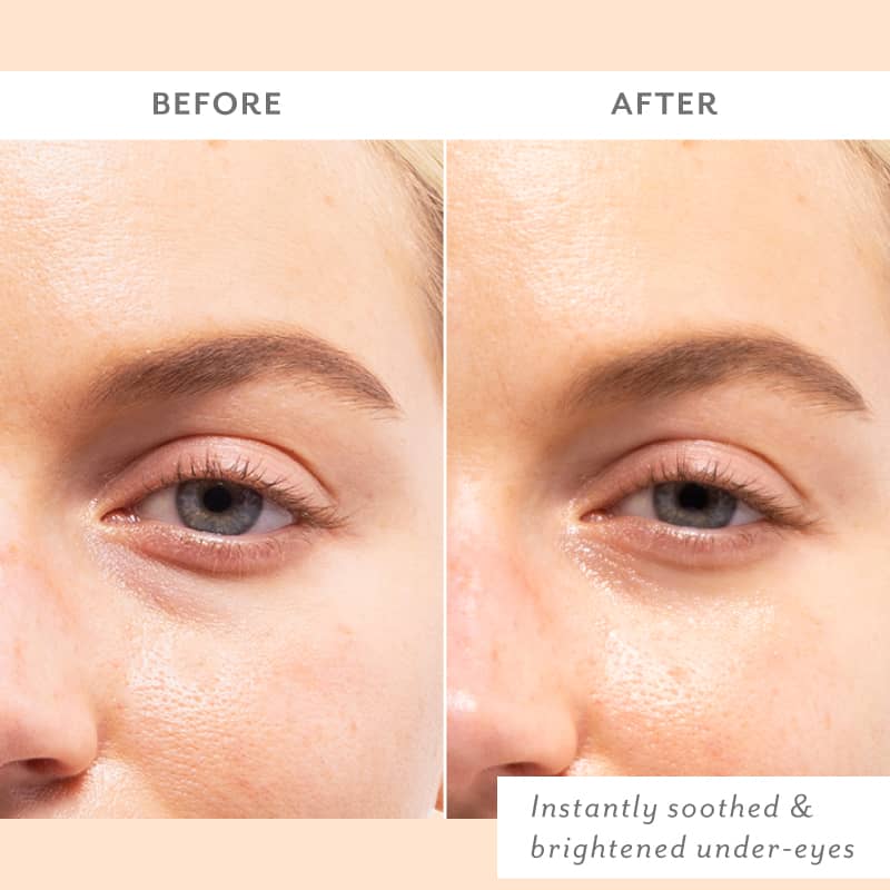 Patchology Skin Remedy Soothing Eye Gel