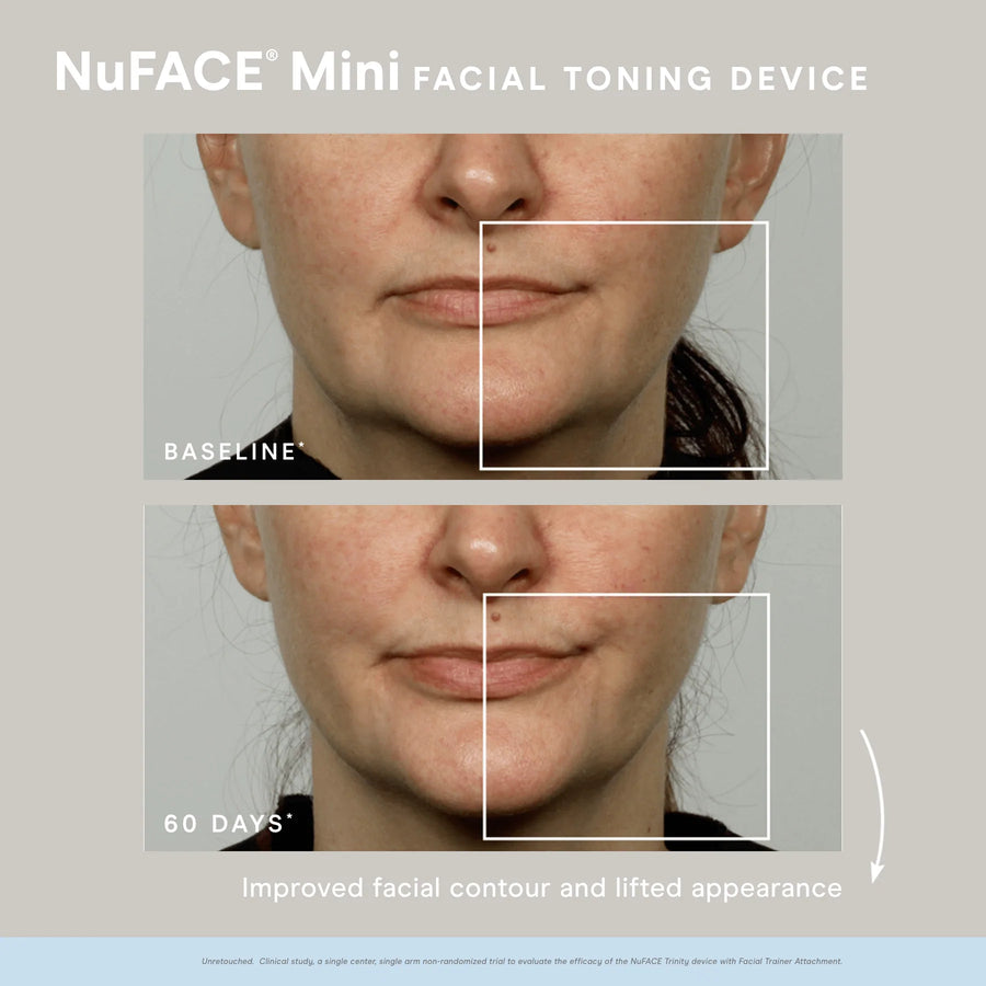 NuFace MINI Facial Toning Device